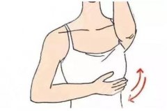 副乳切除后有哪些注意事項