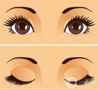 縫合雙眼皮手術(shù)有什么優(yōu)點(diǎn)