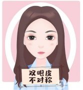 激光去除黑眼圈怎么樣，好處是什么