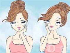 激光去眼袋有哪些優(yōu)勢和注意事項