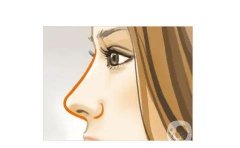 鼻孔縮小手術(shù)是否會出現(xiàn)反彈呢？