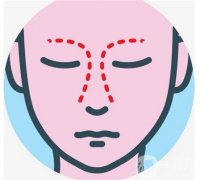 鼻翼縮小手術的后遺癥及預防措施