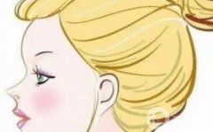 玻尿酸豐蘋果肌有哪些副作用