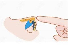 矯正朝天鼻后多長時間可以洗臉