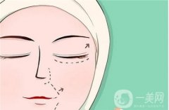 全切與埋線雙眼皮手術(shù)有何優(yōu)缺點(diǎn)？
