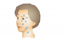 什么年齡適合做線雕？越早越好嗎