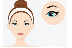 什么是切開雙眼皮？有什么優(yōu)點(diǎn)