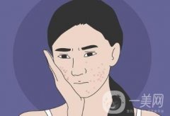 人造酒窩什么時(shí)候可以恢復(fù)？