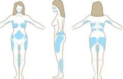 什是吸脂縮小乳房，效果怎么樣？