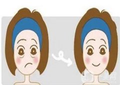 懸吊提升除皺手術(shù)的優(yōu)勢有哪些