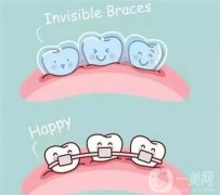 牙齒矯正的設備有哪些