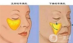 影響自體脂肪填充淚溝維持時間的因素有哪些？