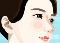 有哪些鼻翼縮小術的手術方法