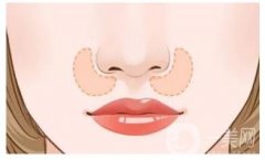 有哪些鼻整形術的常見方法