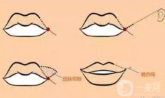 有哪些因素決定漂唇的維持時間？