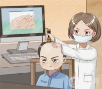 植發(fā)的風險有哪些