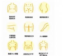 抽脂手術有哪些誤區(qū)
