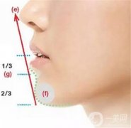 玻尿酸注射下巴后是否會變硬？