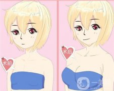 副乳切除術是否會影響乳房？