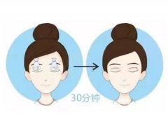 割雙眼皮的潛在風(fēng)險(xiǎn)有哪些