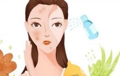 激光美白是否會(huì)反彈呢？