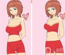 假體隆胸手術(shù)后的護(hù)理要點(diǎn)有哪些呢？