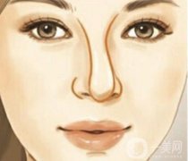 鼻整形失敗修復(fù)有哪些注意事項(xiàng)