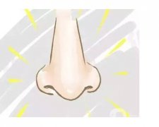 鼻翼縮小手術(shù)是怎么做的