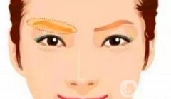 提眉手術(shù)的風(fēng)險有哪些