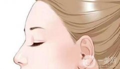 提眉手術(shù)與雙眼皮手術(shù)需要間隔多久？