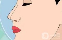 駝峰鼻是否需要磨骨？如何進(jìn)行矯正