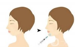 下巴注射玻尿酸后為什么會出現(xiàn)硬塊呢？