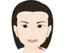 下頜角整形手術(shù)后面部會(huì)下垂嗎