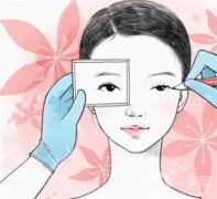 眼皮抽脂的常見方法有哪些