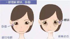 眼袋修復(fù)的方法有哪些？