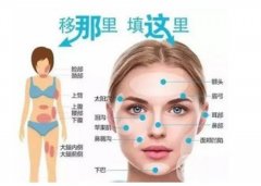 自體脂肪填充額頭有什么缺點？