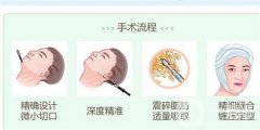 面部能否進行水動力吸脂？安全性如何？