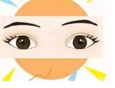 納米無(wú)痕雙眼皮的手術(shù)過(guò)程