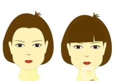 顴骨墊高手術(shù)的效果如何，恢復(fù)時間長嗎