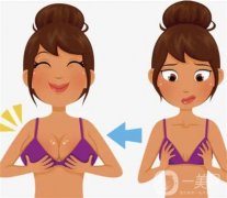 乳暈縮小手術(shù)的效果如何呢？