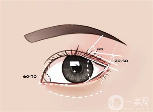 天津璦珊整形醫(yī)院雙眼皮整形日記_價格表介紹一覽