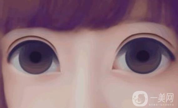 重慶開眼角手術(shù)大概需要多少錢呢?