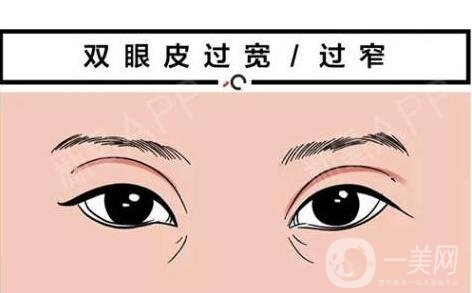 韓式*開眼角價(jià)格 韓式*開眼角多少錢？